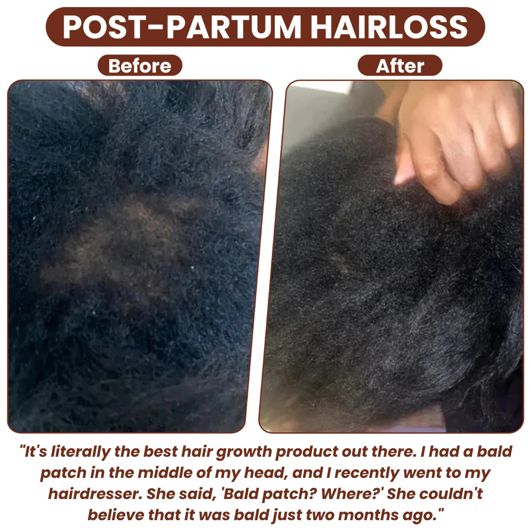 Batana Hair Growth Oil