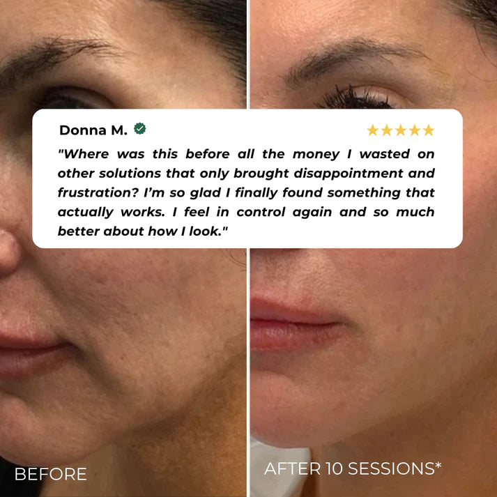 Nuvira™ EMS Beauty Device