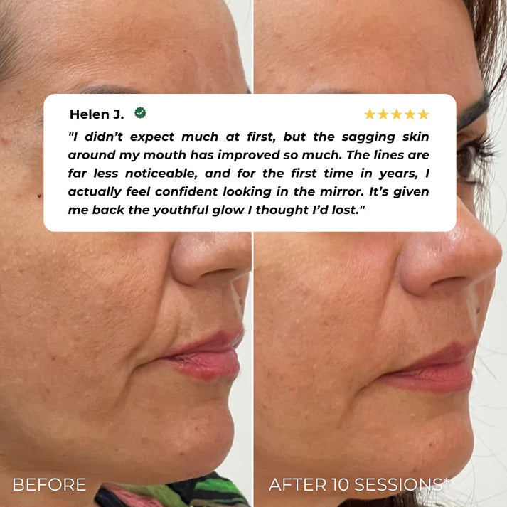 Nuvira™ EMS Beauty Device