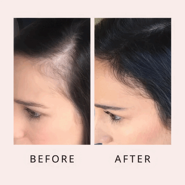 Nuvira™ Hair Growth Roll-on Serum