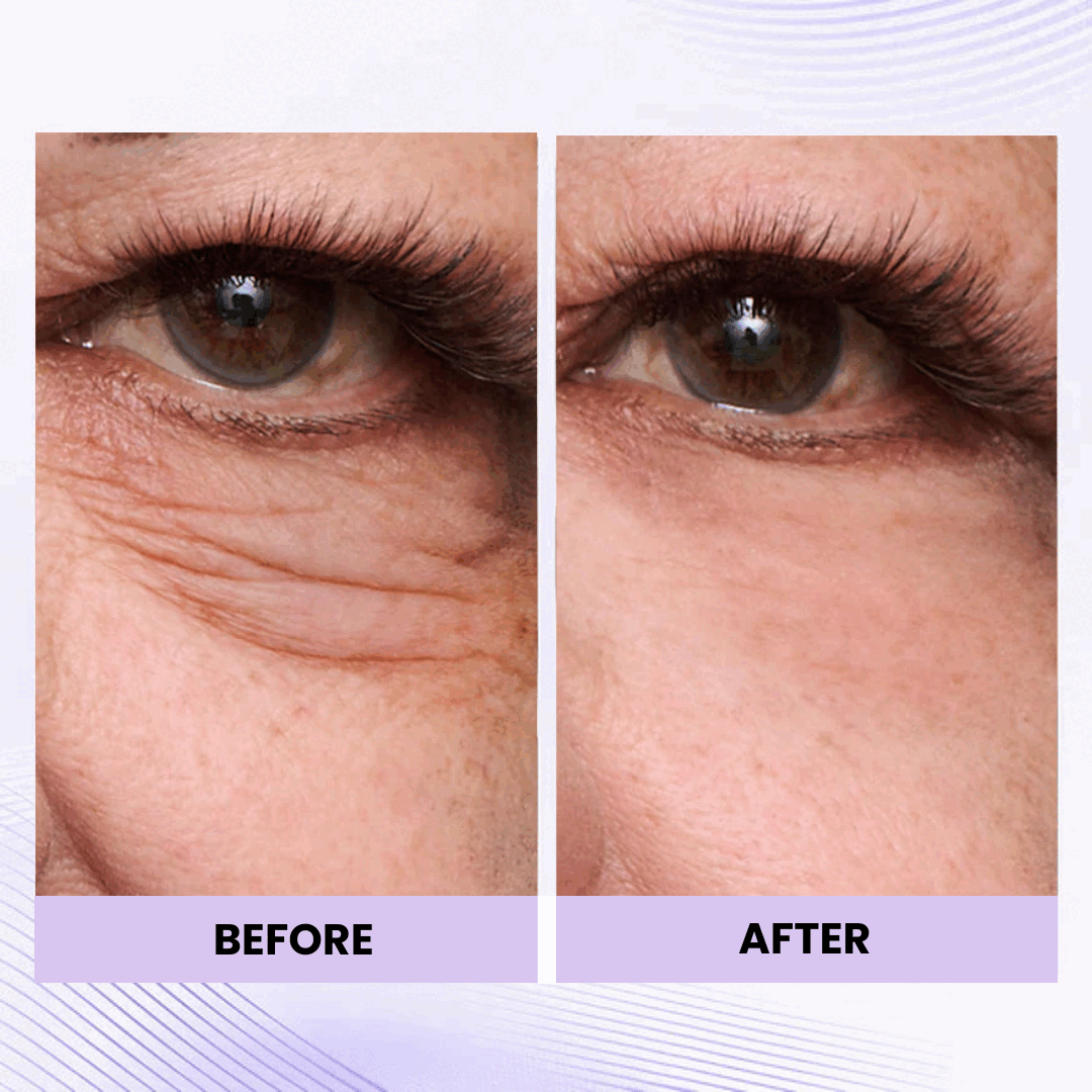 Instant Eye Tightener