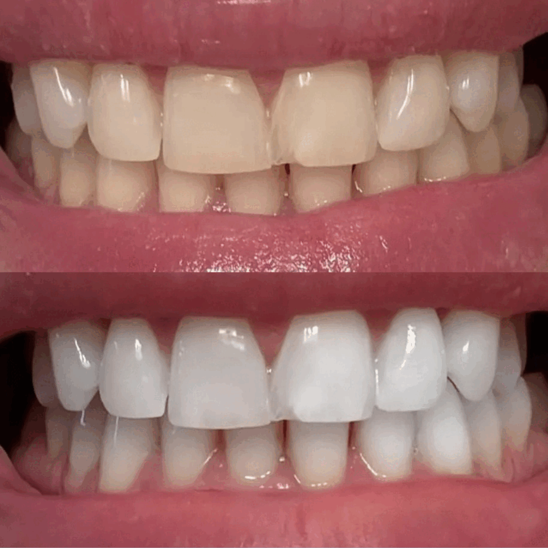 Nuvira™ Niacinamide Toothpaste