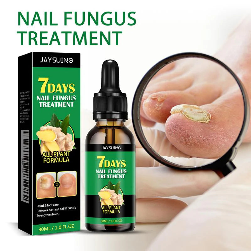Natural Ginger Nail Treatment