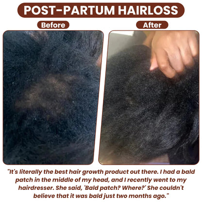 Batana Hair Growth Oil