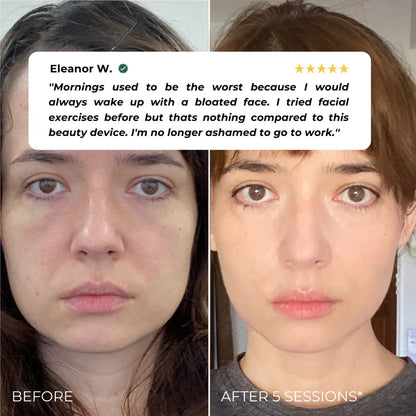 Nuvira™ EMS Beauty Device