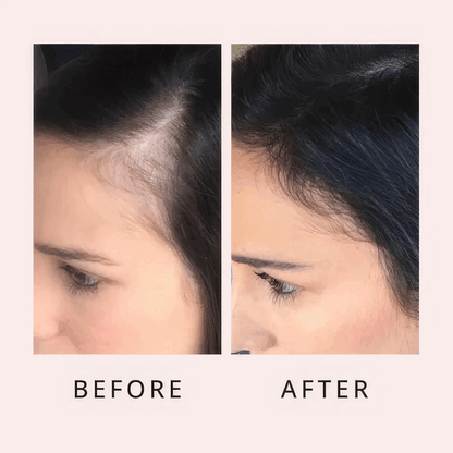 Nuvira™ Hair Growth Roll-on Serum