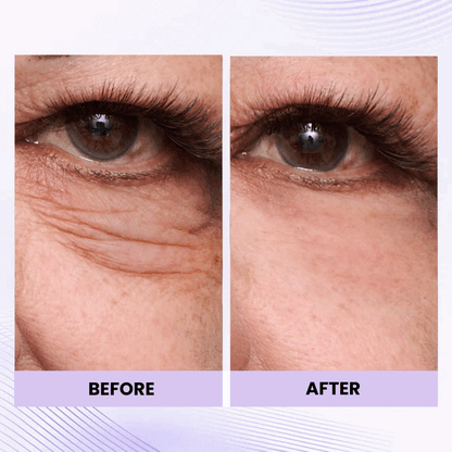 Instant Eye Tightener