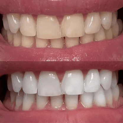 Nuvira™ Niacinamide Toothpaste